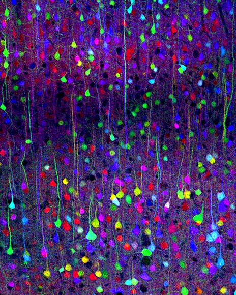 脳幹ニューロン